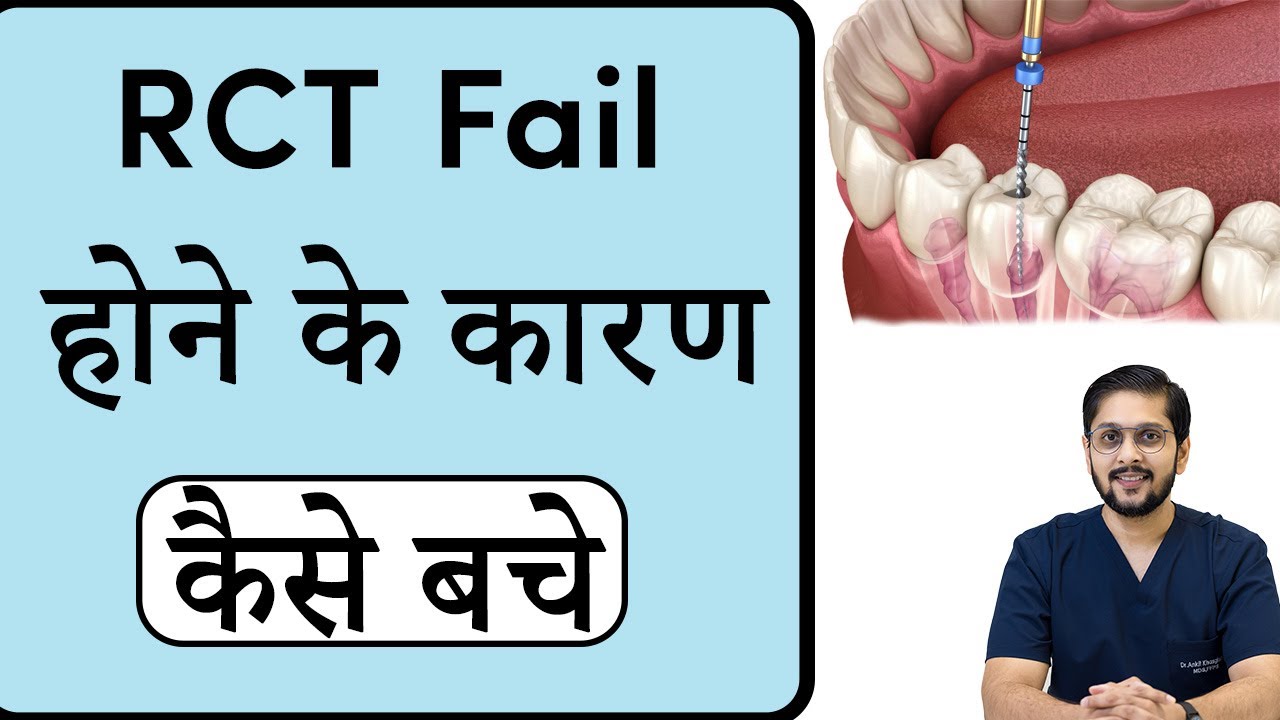 RCT fail होने के कारण | Best root canal treatment in Indore | Seraphic Dental in Indore