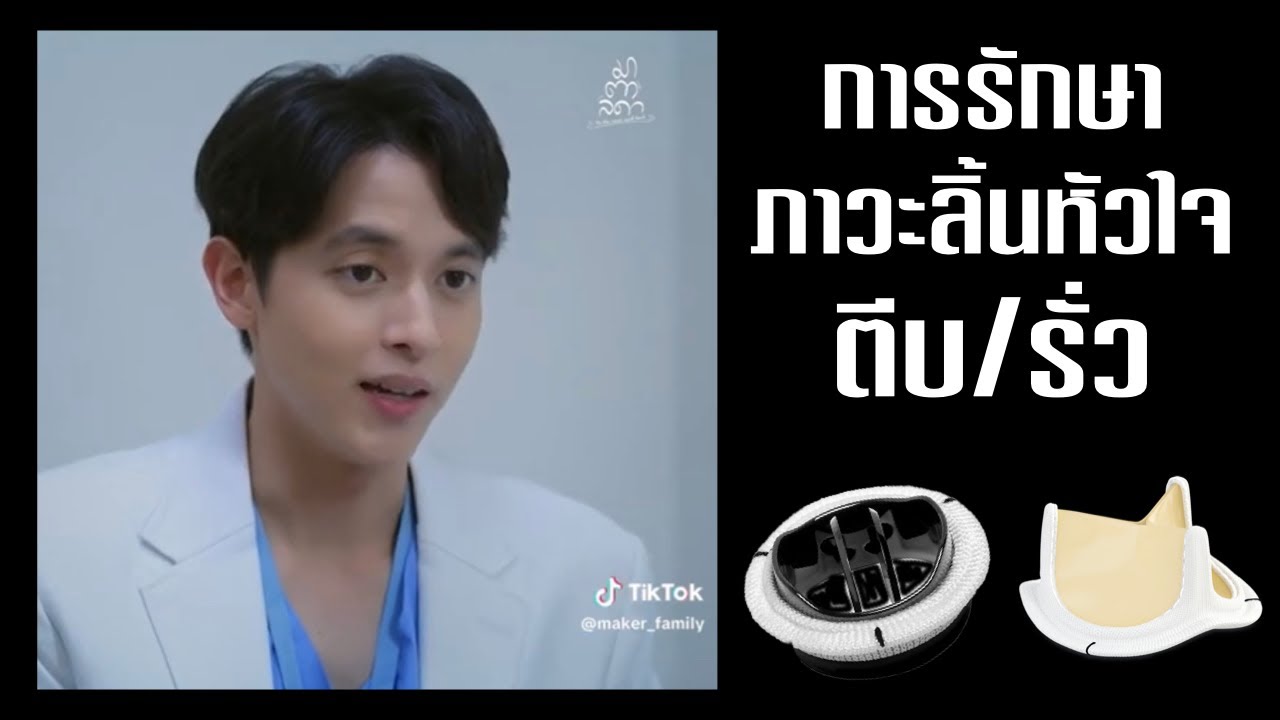 🫀การผ่าตัดรักษาโรคลิ้นหัวใจรั่ว ตีบ