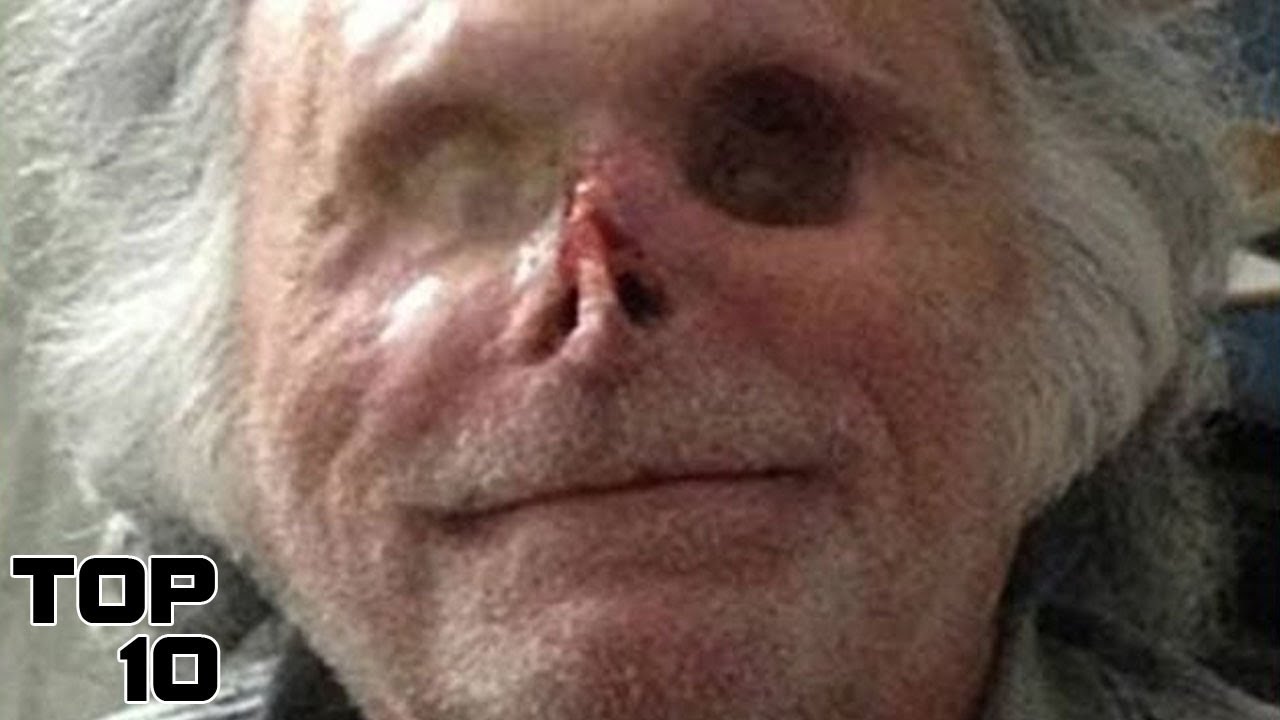 Top 10 Terrifying People Who Became Real Life Zombies