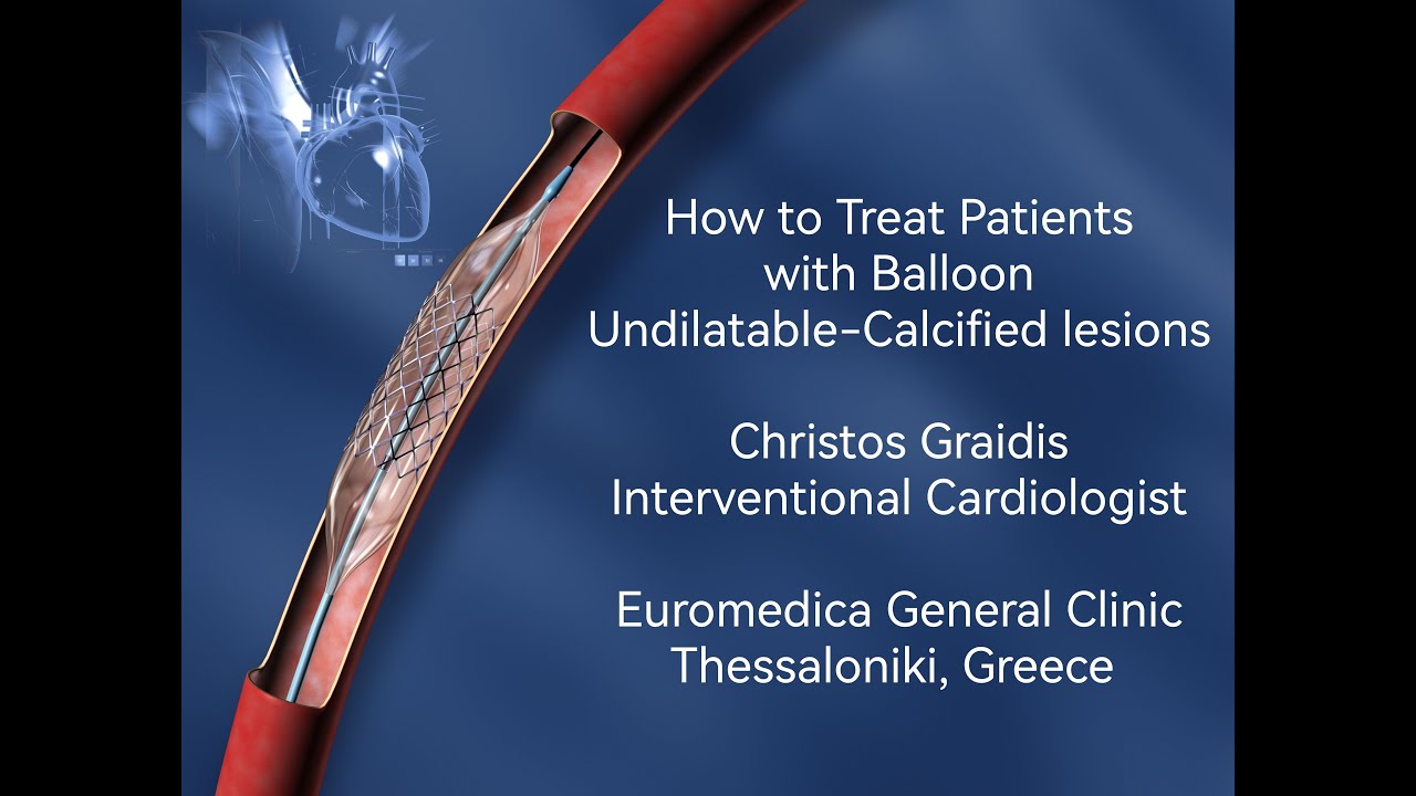 How to treat patients with undilatable / calcified coronary artery lesions