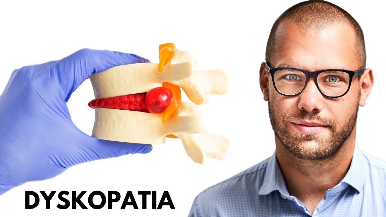 DYSKOPATIA: WYPUKLINA, a PRZEPUKLINA (protruzja, ekstruzja, sekwestracja) - TOP 3 INFORMACJE !