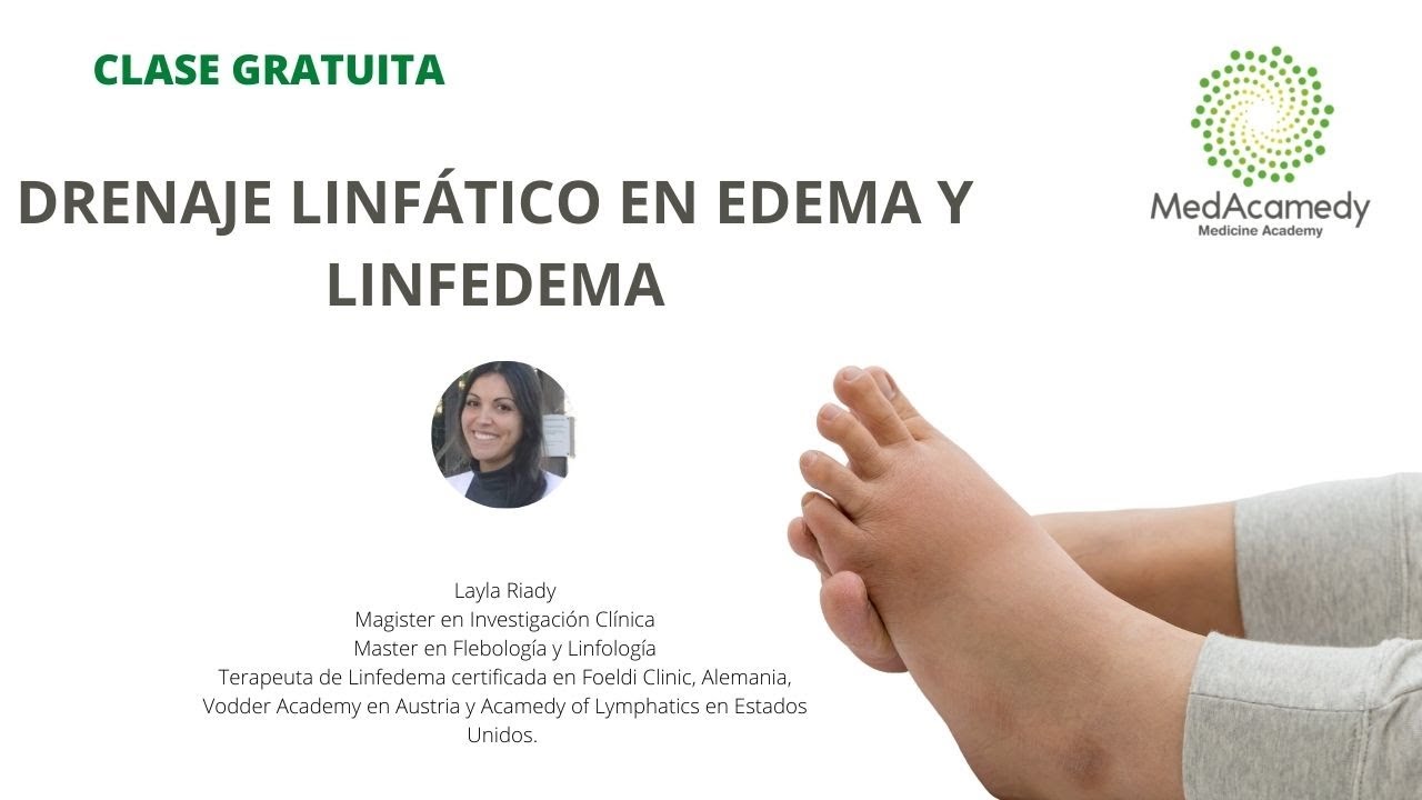 charla:  manejo edema y linfedema