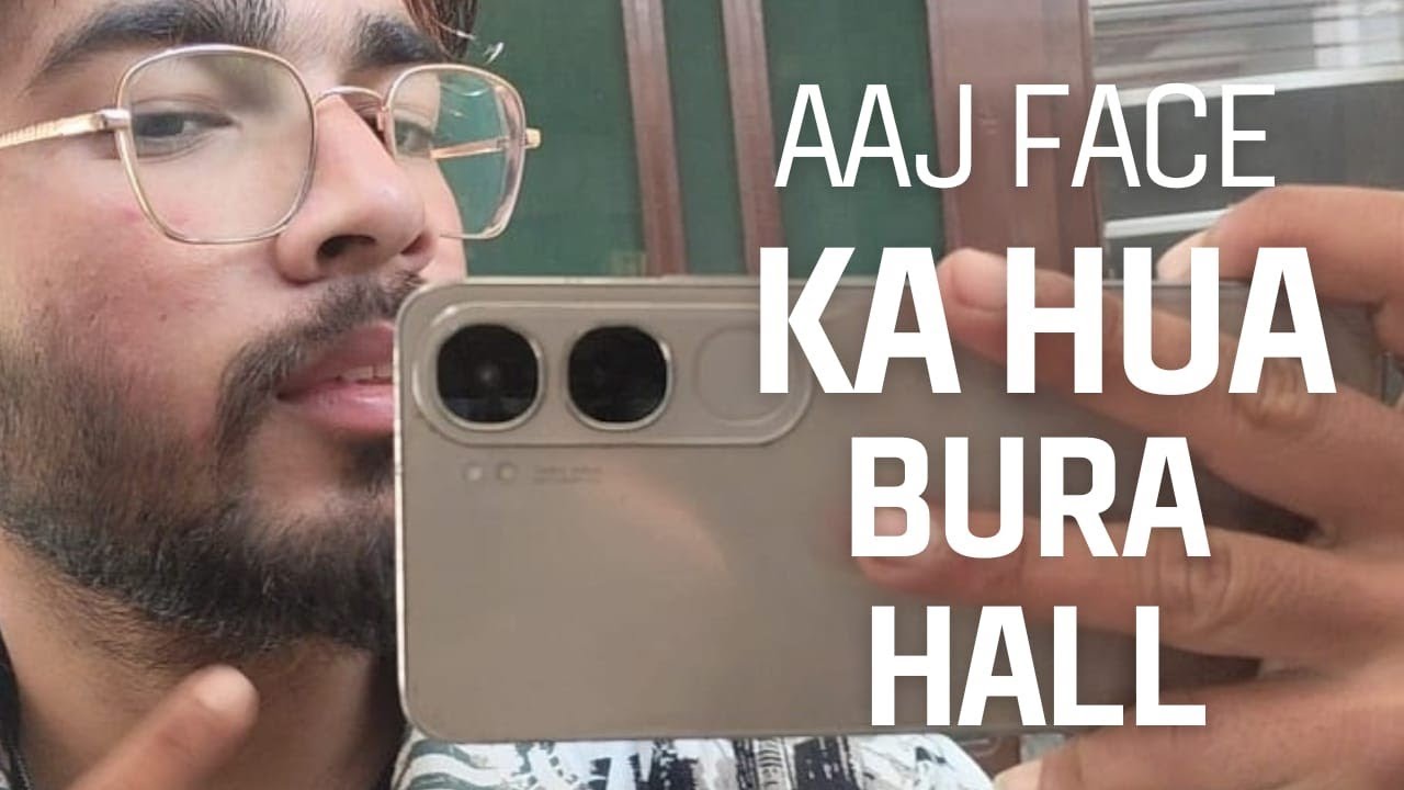 Aaj Ka Din Bana Disaster 😭 Face Ka Bura Haal !!(vlog#16)