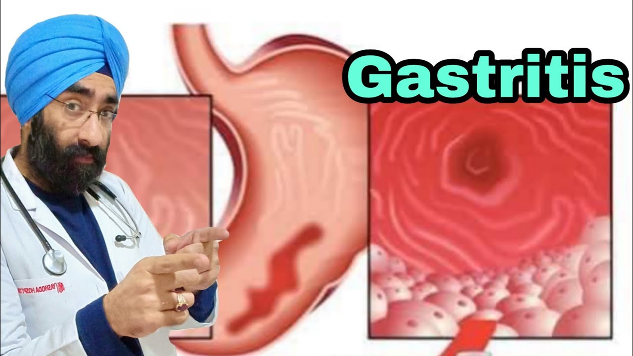 What is Gastritis! Dr.Education (Hindi)