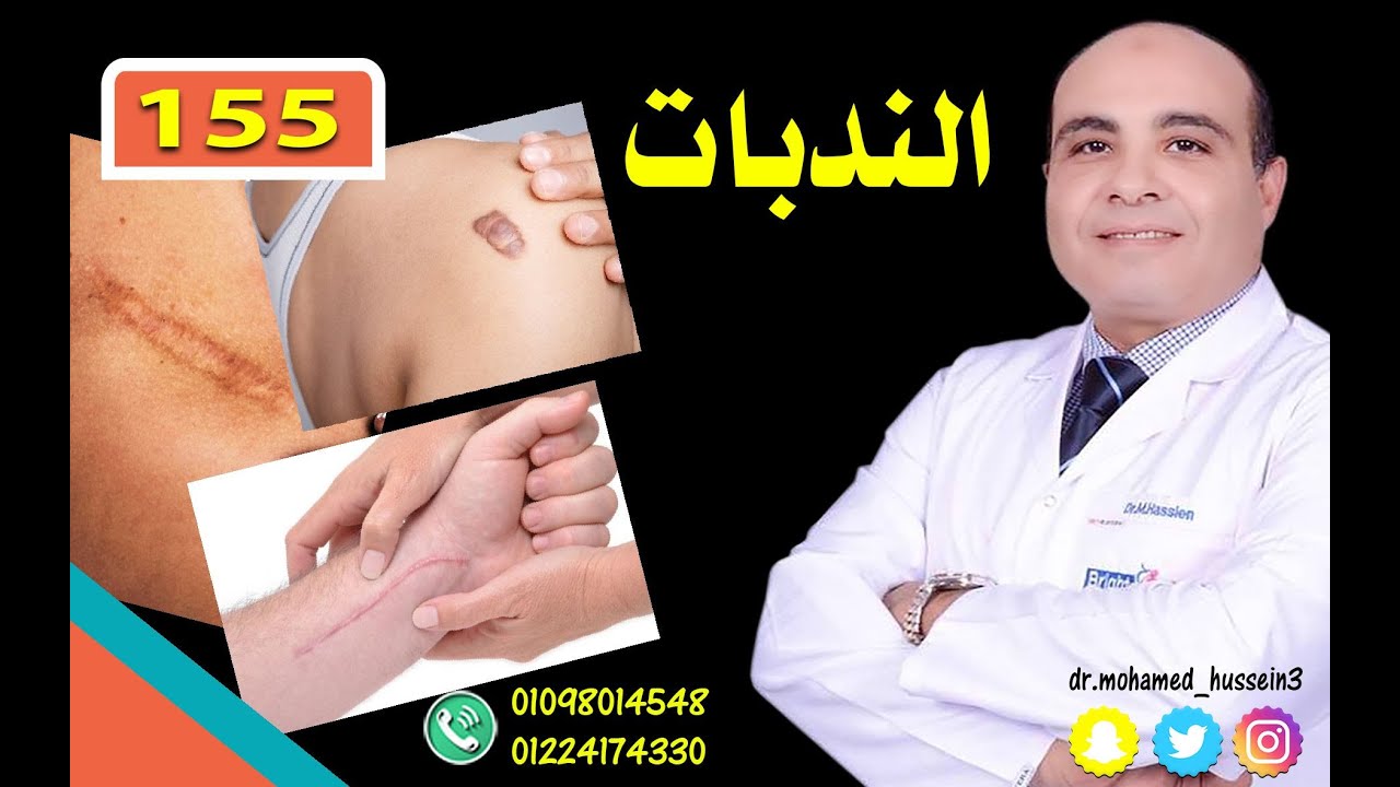 الندبات .. للدكتور محمد حسين - 155