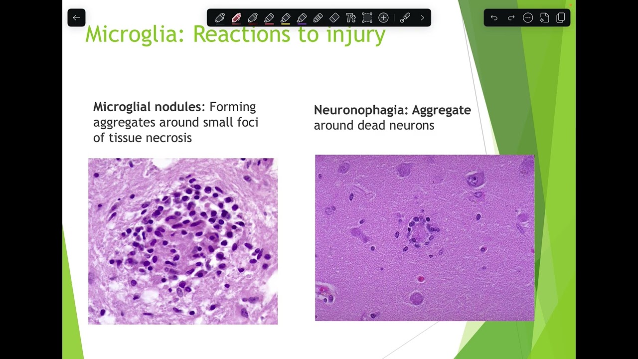 NS: Pathology L1
