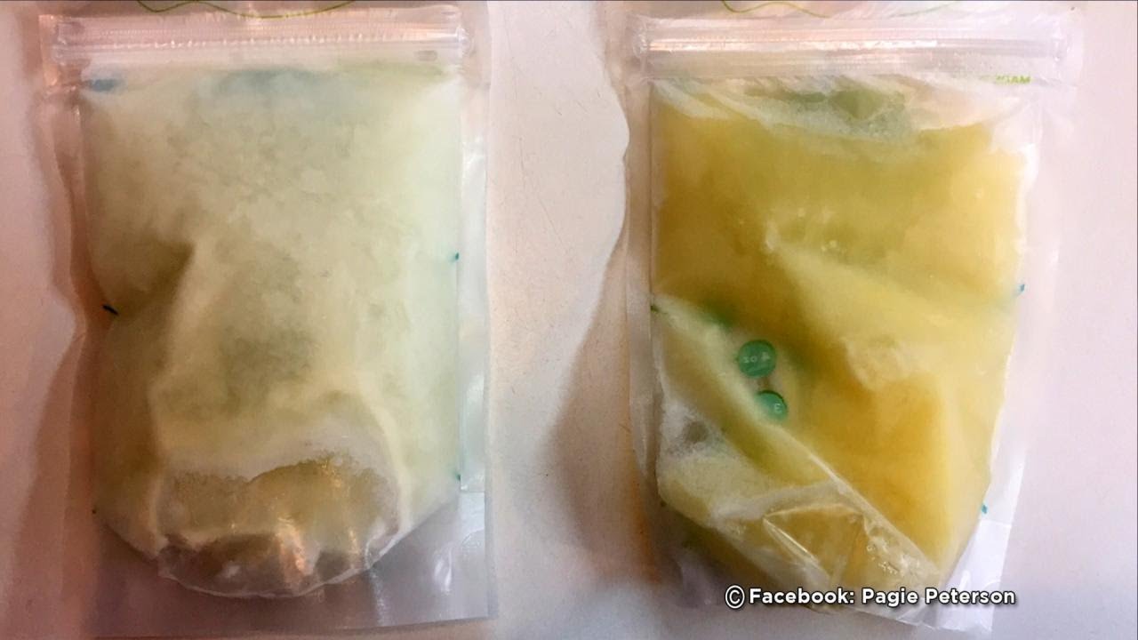 Can Your Breast Milk Change Color When Your Baby is Sick?