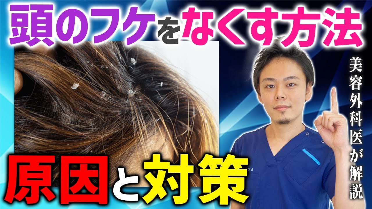 【フケをなくす方法】フケの原因と対策を徹底解明！