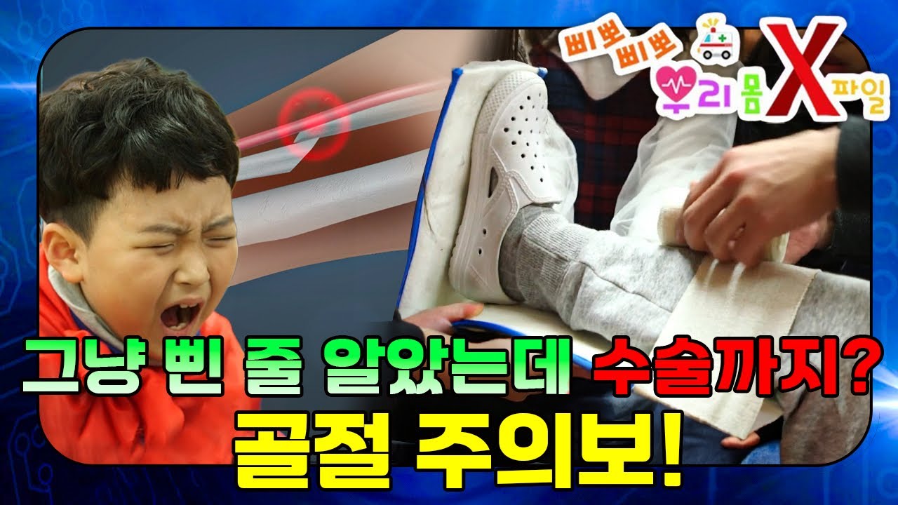 골절 응급처치, 이것만은 꼭 기억하세요!｜뼈가 부러졌을 때｜우리 몸 X파일｜[EBS놀이터]