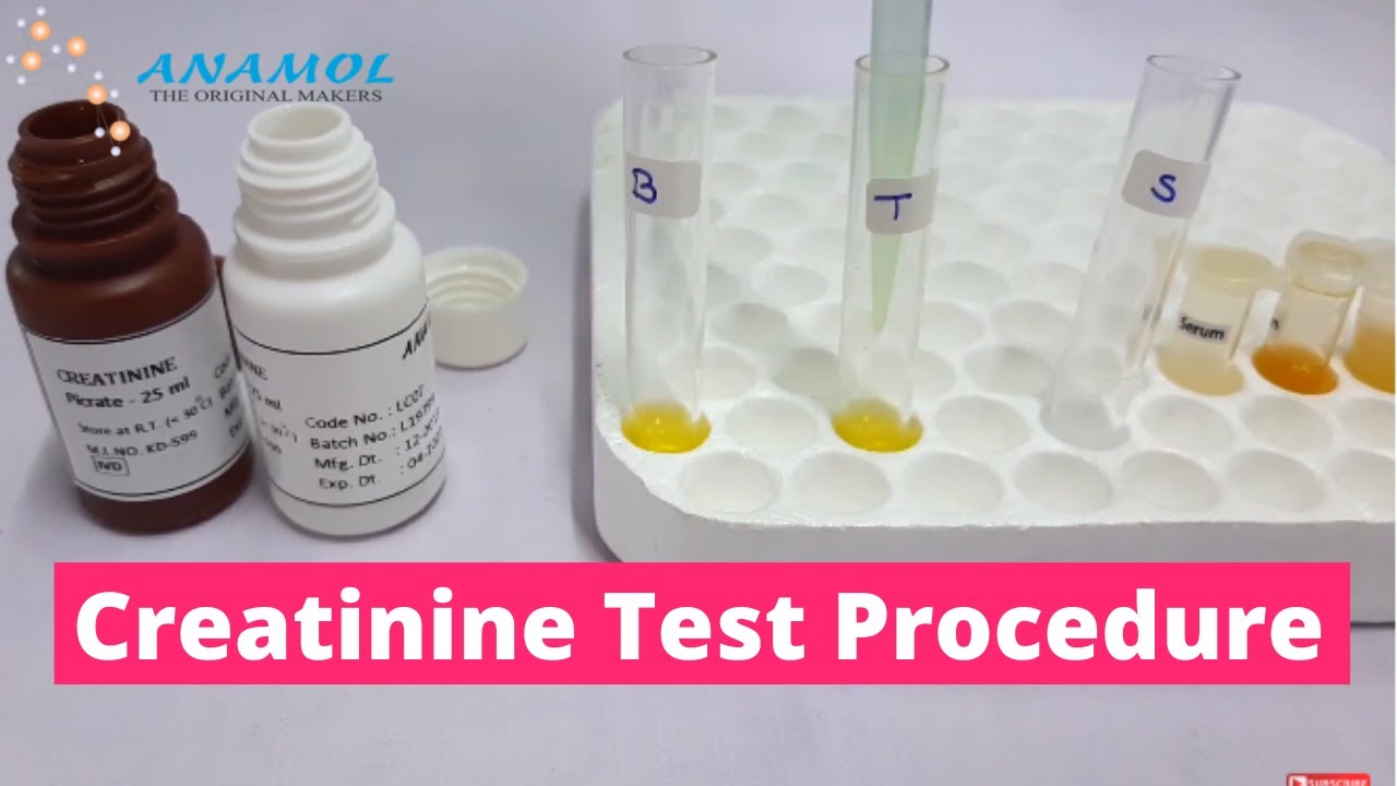 Serum Creatinine Test |  Creatinine Blood Test