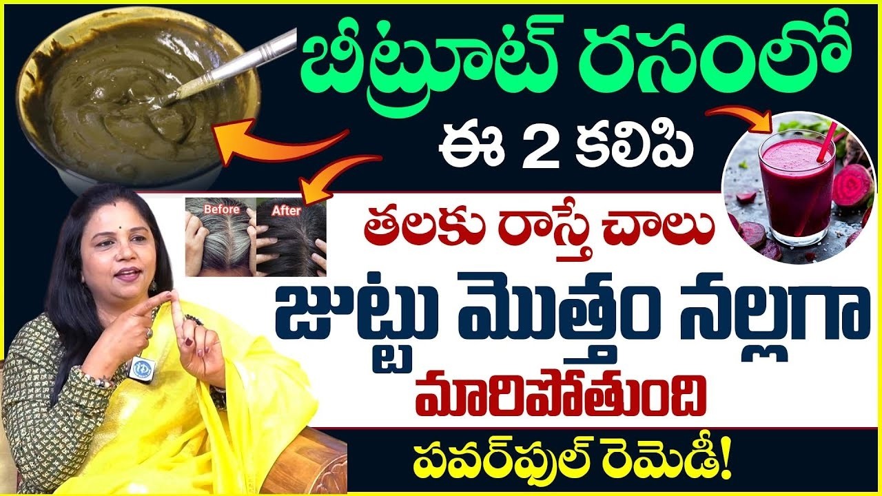 తెల్ల జుట్టు శాశ్వతంగా నల్లగా ఉండిపోతుంది|Grey Hair|Vanaja Ramisetty|iDream Health Plus #greyhair