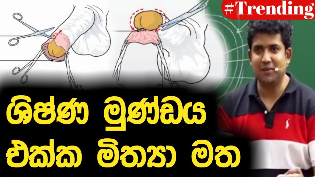 ශිෂ්ණ මුණ්ඩය එක්ක මිත්‍යා මත | Dinesh Muthugala | Episode 155