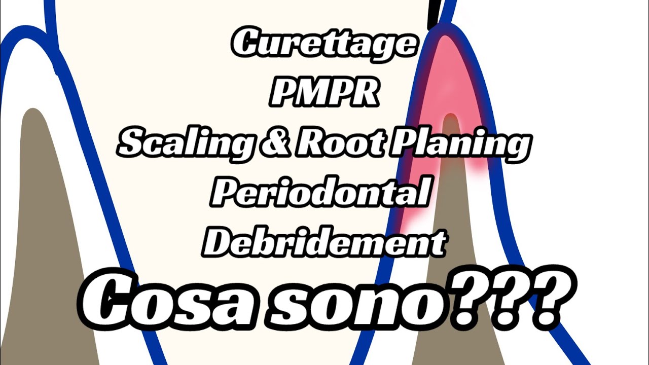Nomenclatura trattamenti parodontali