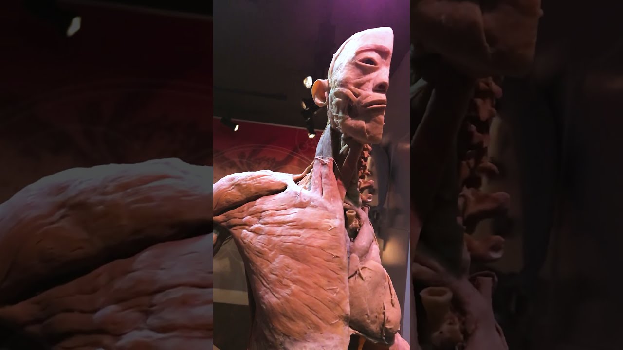 REAL HUMAN BODY MUSEUM-Las Vegas