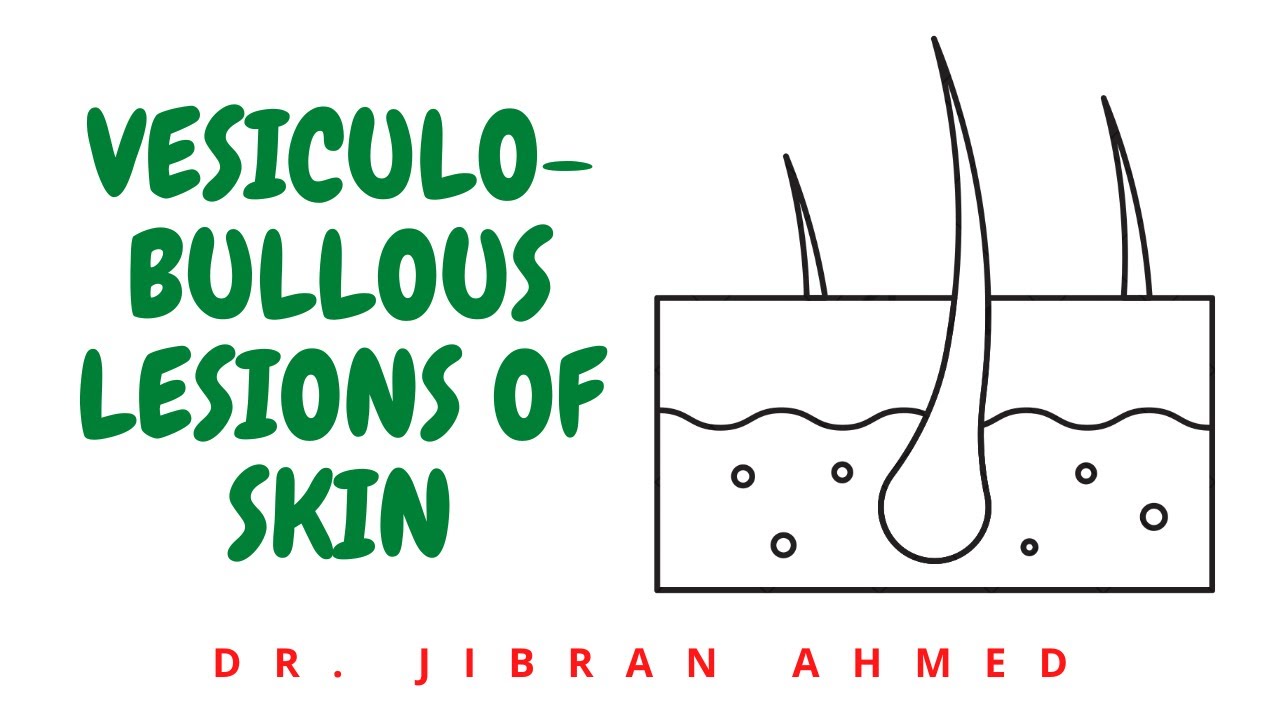 VESICULO-BULLOUS LESIONS  II ROBBINS 10TH E II SKIN II PATHO LECTURES
