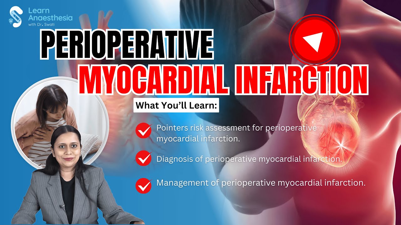 Perioperative Myocardial Infarction | Risk Assessment | Diagnosis | Dr. Swati