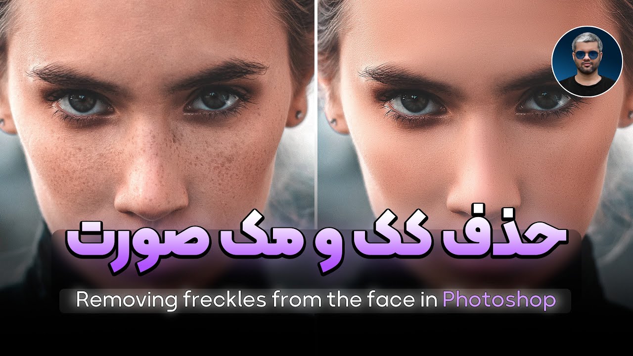 آموزش حذف کک و مک و لک صورت در فتوشاپ | روتوش حرفه‌ای