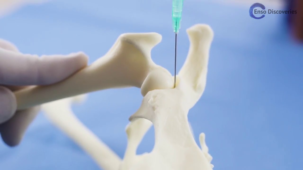 Enso Hip joint injection video