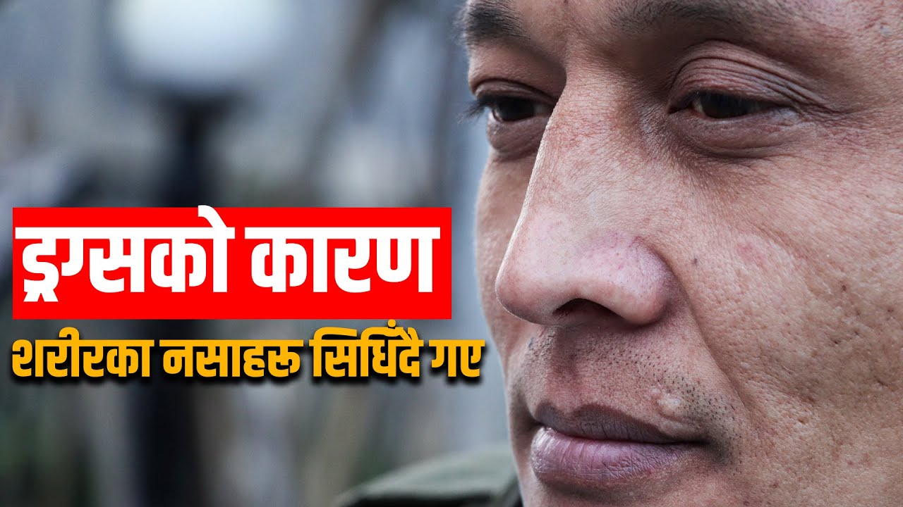 Life Story || ड्रग्सको लतले जीवनप्रति निराशा बढायो || Prayas
