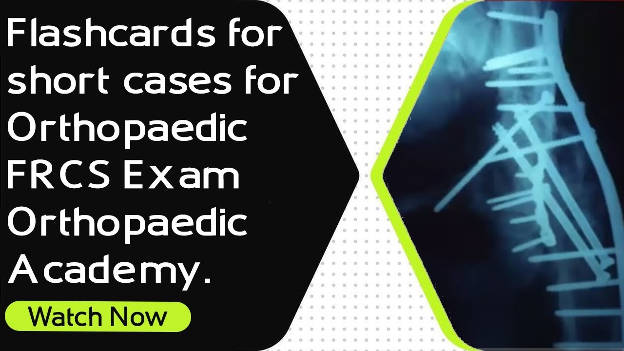 Flashcards for short cases for Orthopaedic FRCS Exam । Orthopaedic Academy.