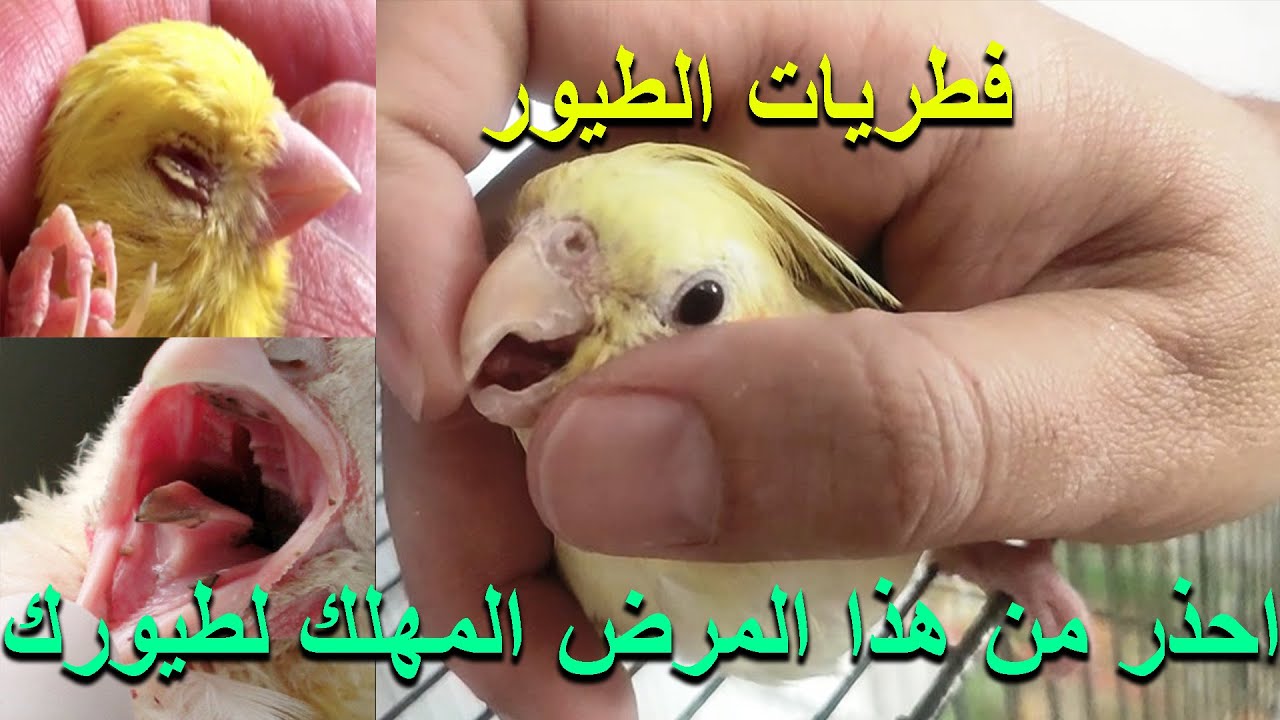 مرض الفطريات (الاعراض - المسببات - العلاج)