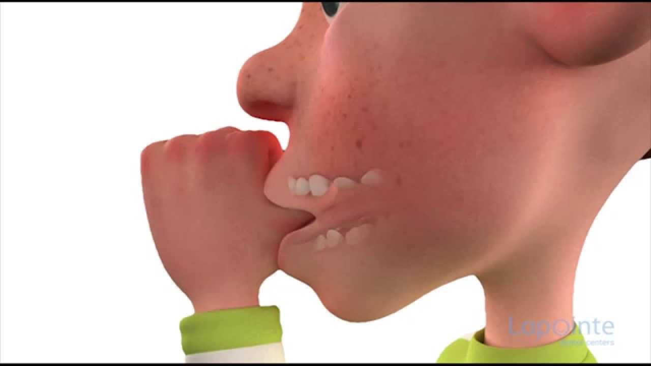 Thumb sucking, a bad habit (kids&rsquo; edition)  - Lapointe dental centres
