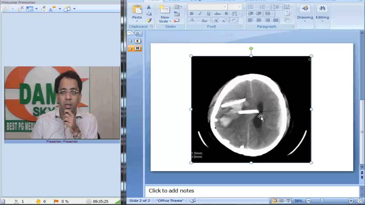 Radiology Spotters Part 9 Intracranial Ryles Tube