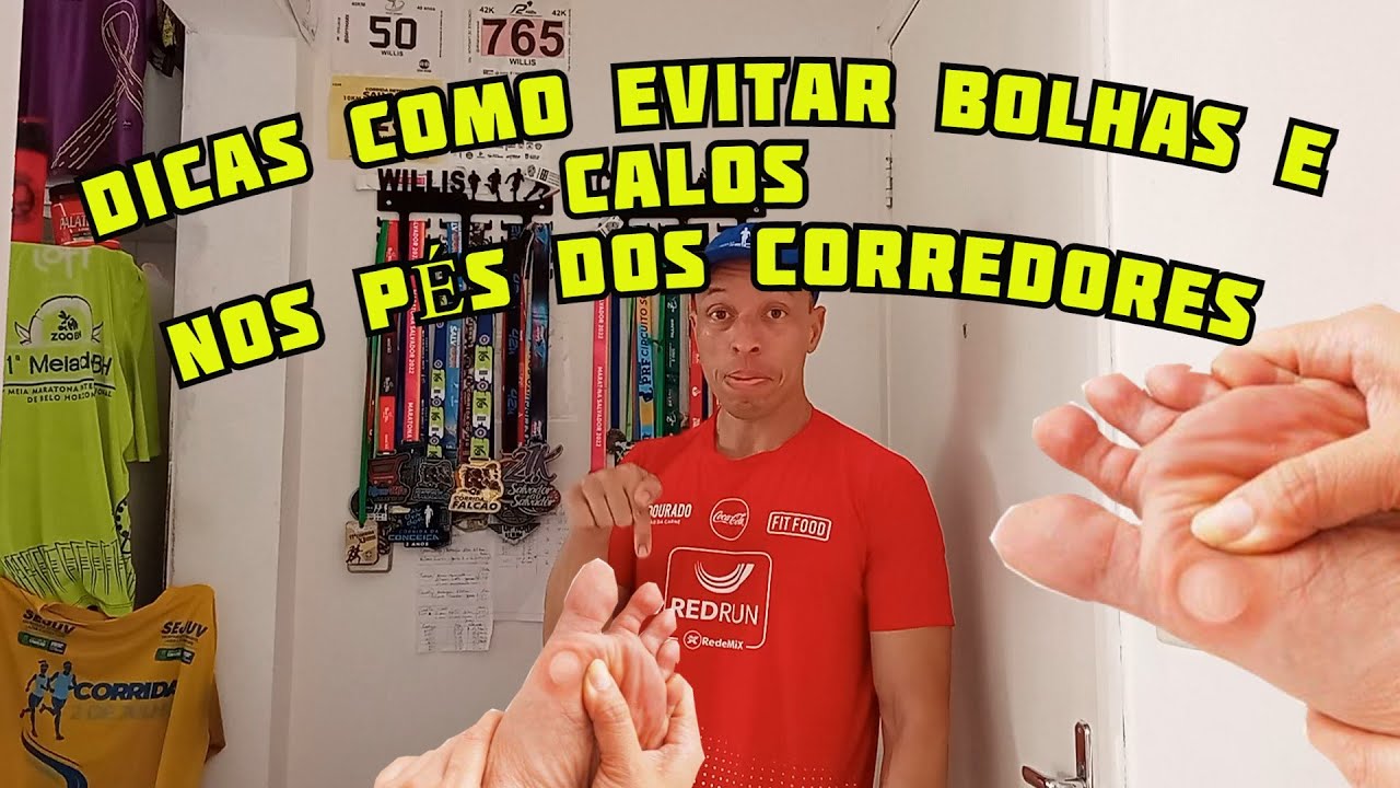 Dicas Como Evitar Bolhas e Calos nos Pés durante a Corrida