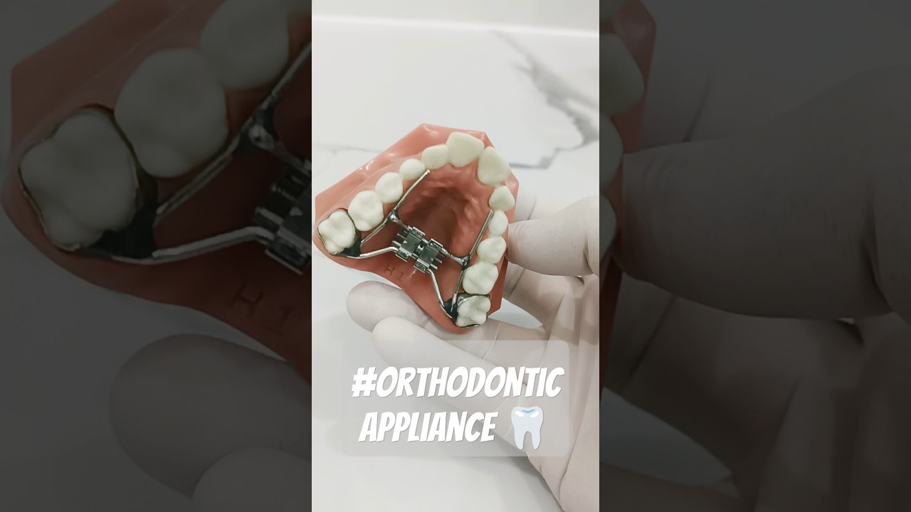 orthodontic appliances #dental #dentist #teeth #appliances #toys