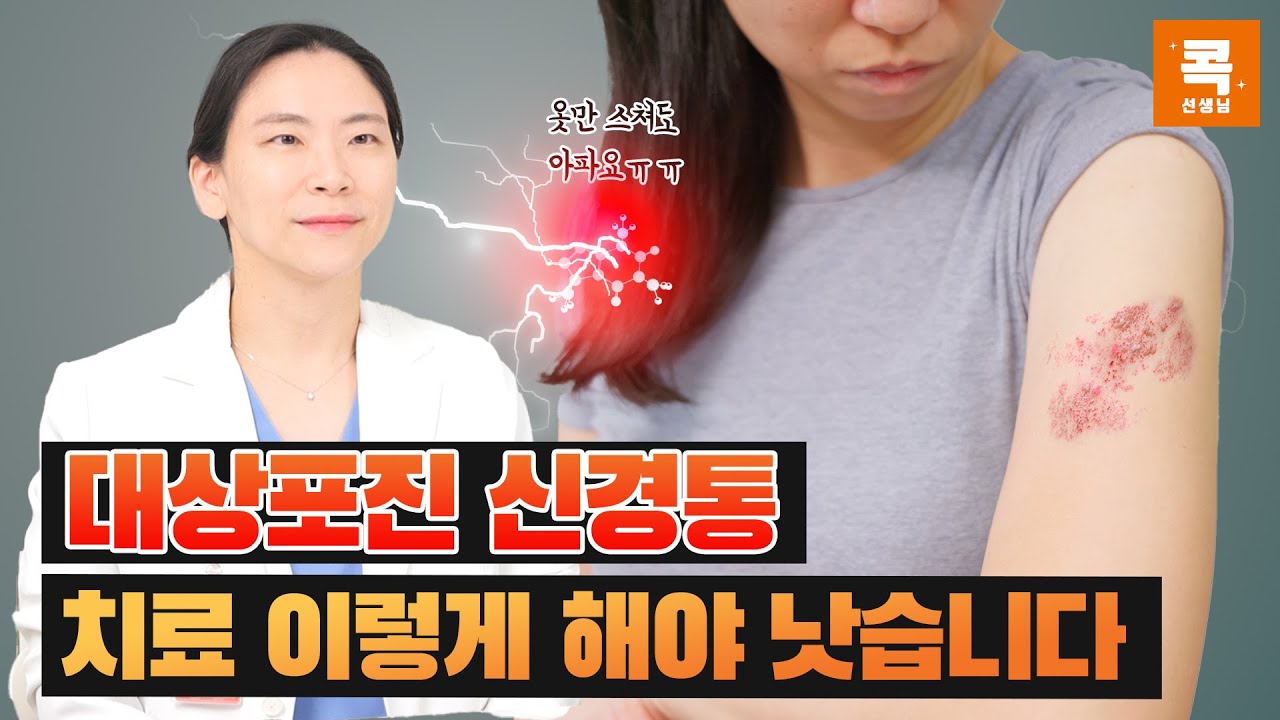 대상포진 후유증 신경통 완치사례, 이렇게 치료해야 낫습니다. (콕통증의학과 윤은장 원장)