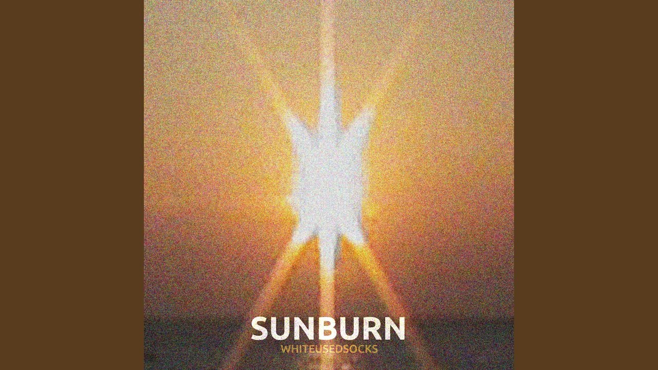 Sunburn
