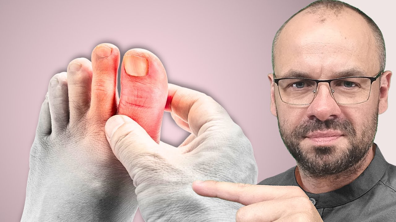 Kwas moczowy niszczy od środka. Działaj, zanim zachorujesz!