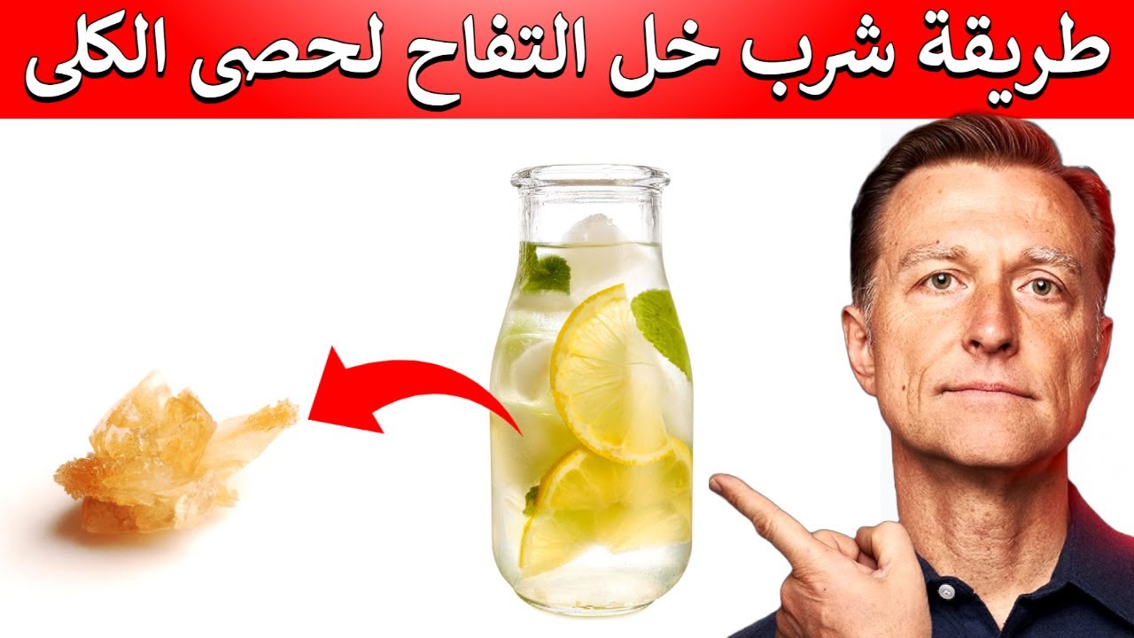اشربوا خل التفاح بهذه الطريقة للحماية من حصى الكلى