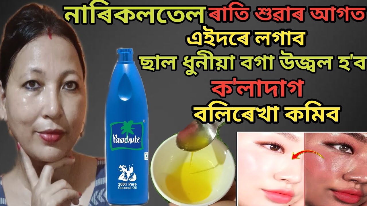 নাৰিকল তেল ৰাতি শুৱাৰ আগত এইদৰে লগাব ছাল ধুনীয়া বগা উজ্বল হ'ব ক'লাদাগ বলিৰেখা কমিব | vlog 