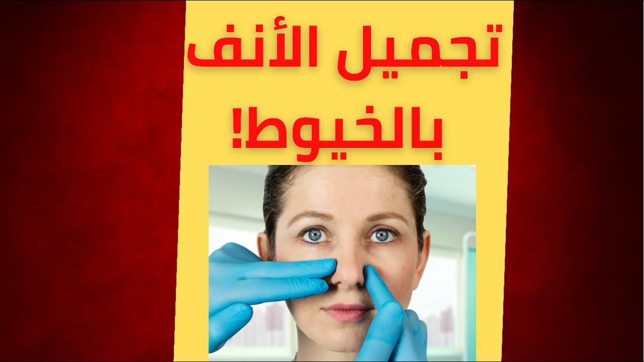 تجميل الأنف بالخيوط!