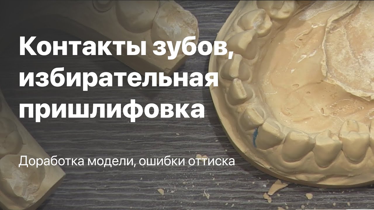 Контакты зубов, избирательная пришлифовка зубов, окклюзия и прикус. Доработка модели  ошибки оттиска