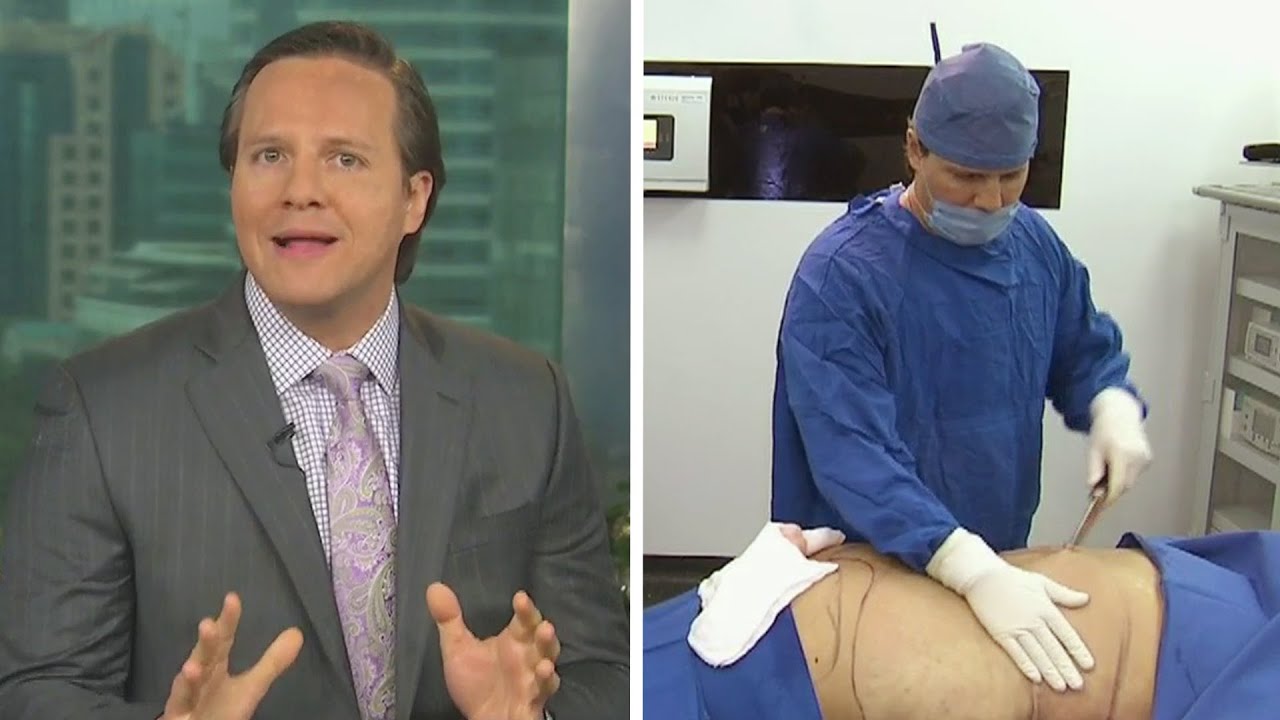 Conoce la liposucción en 4D