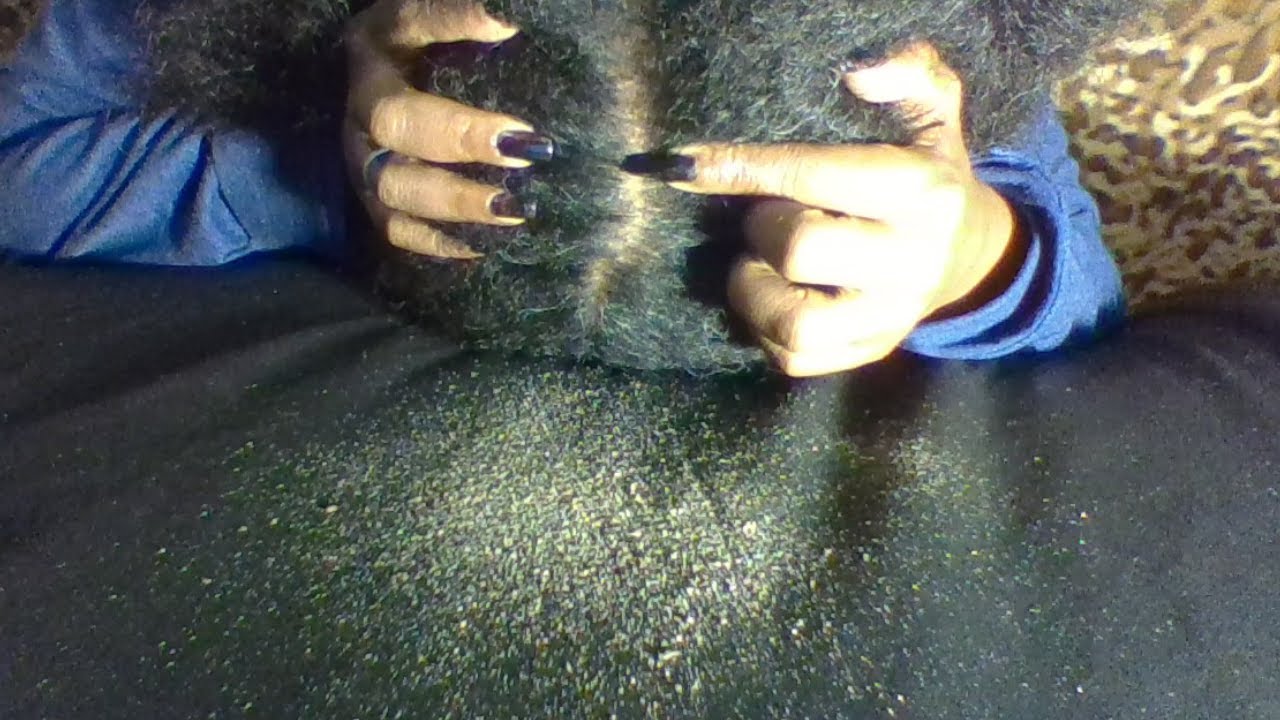 Dandruff Scratching Scalp/Satisfying Nail Scratch/ Flying Flakes Asmr