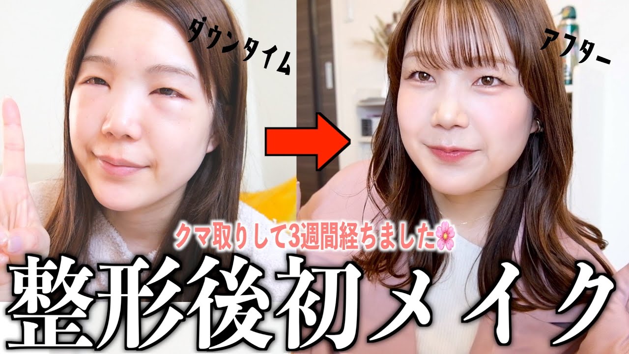 【報告】整形後初メイクした！！クマ隠しの工程省けそうで幸😅🌸