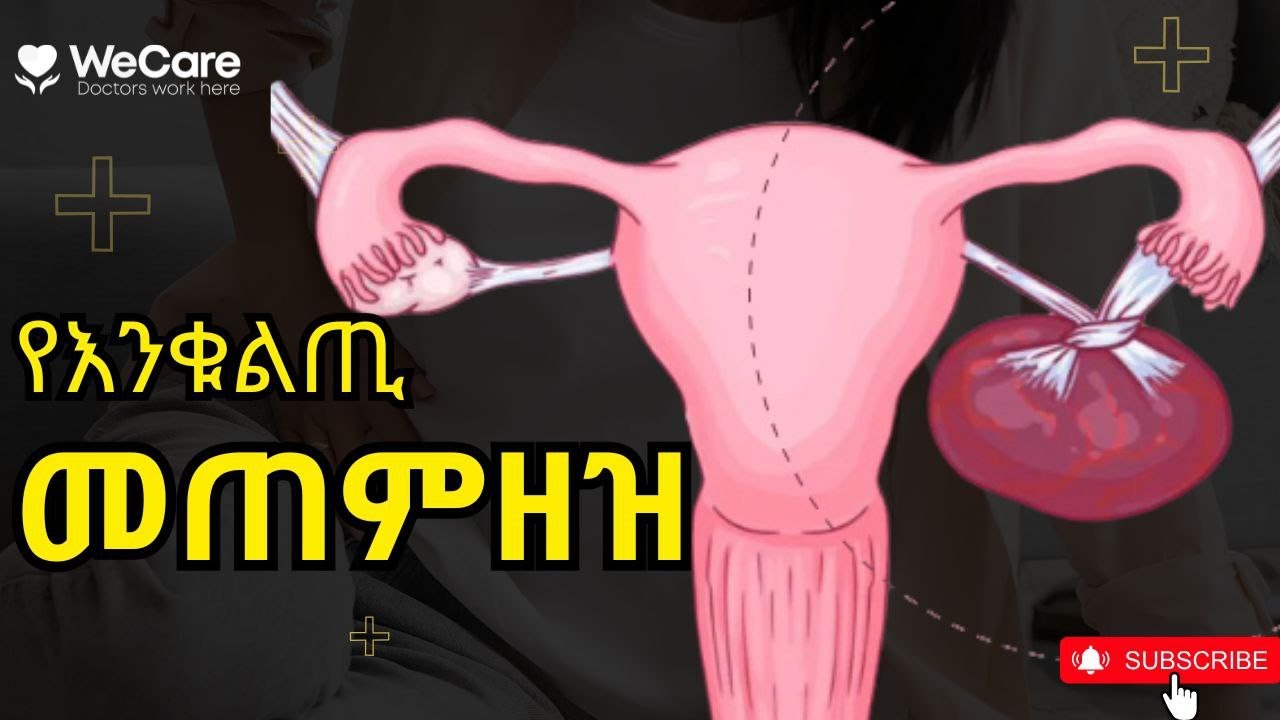 የእንቁልጢ መጠምዘዝ !! ችላ ሊባሉ የማይገቡ ምልክቶች !!