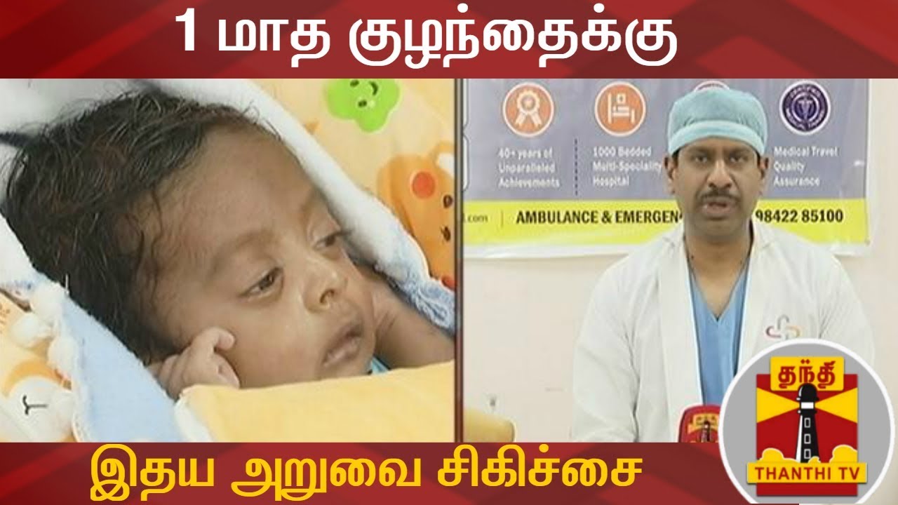 1 மாத குழந்தைக்கு இதய அறுவை சிகிச்சை | Open Heart Surgery | Thanthi TV