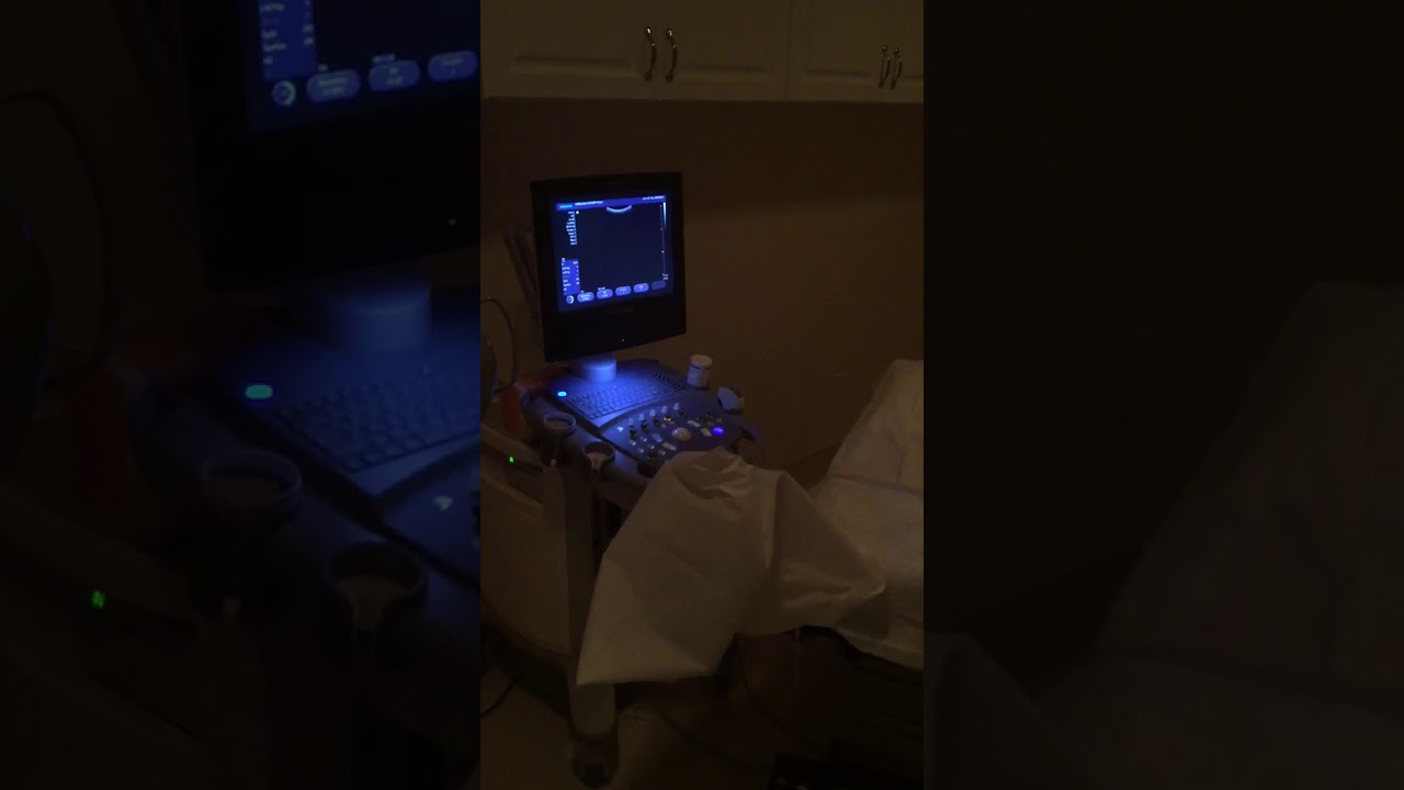 Carolina Conceptions Embryo Transfer Room