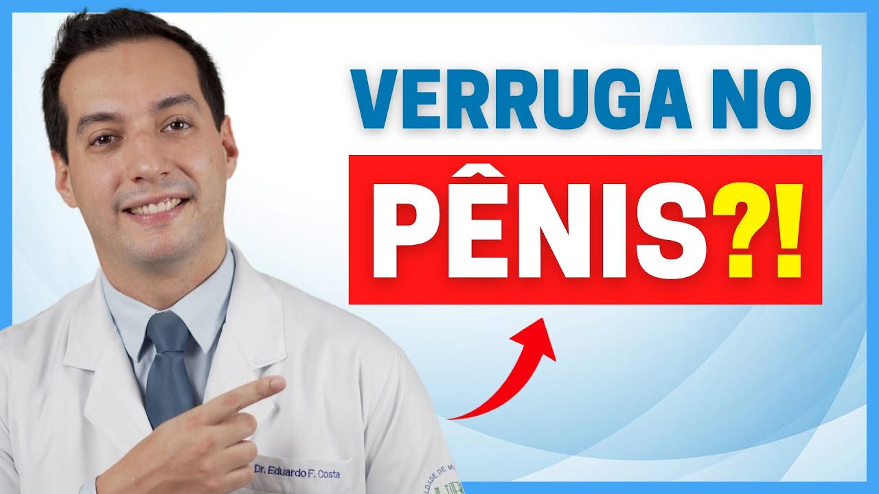 CINCO CAUSAS DE VERRUGAS NO PÊNIS E COMO TRATA-LAS!