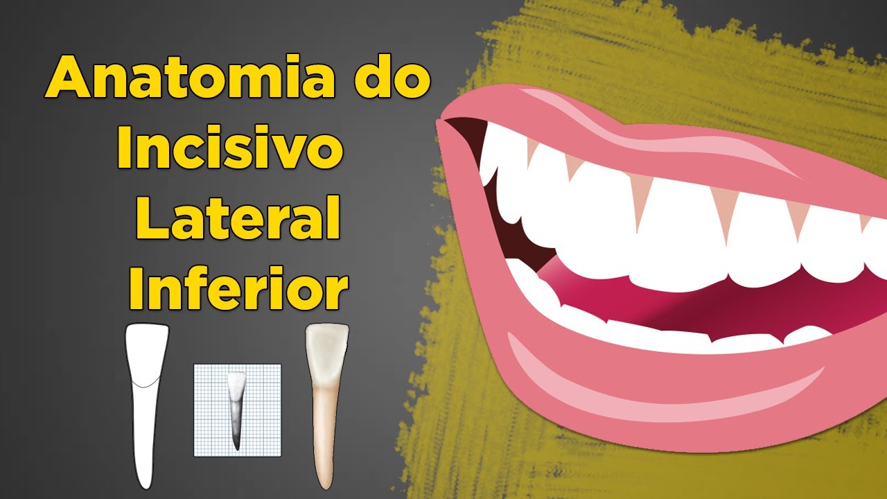 Anatomia do Incisivo Lateral Inferior - Resumo de Anatomia Dental - Dente 32 e 42
