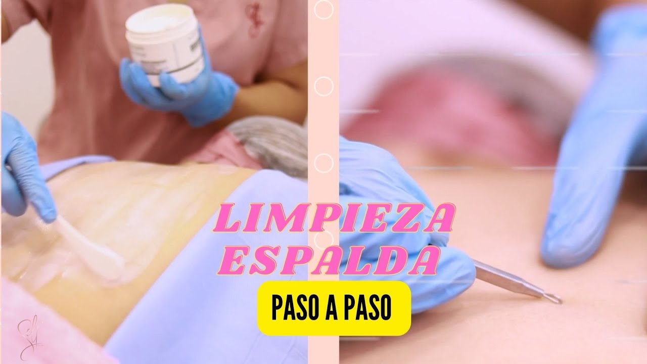 LIMPIEZA PROFUNDA DE ESPALDA PARA ACNÉ - BACK RITUAL