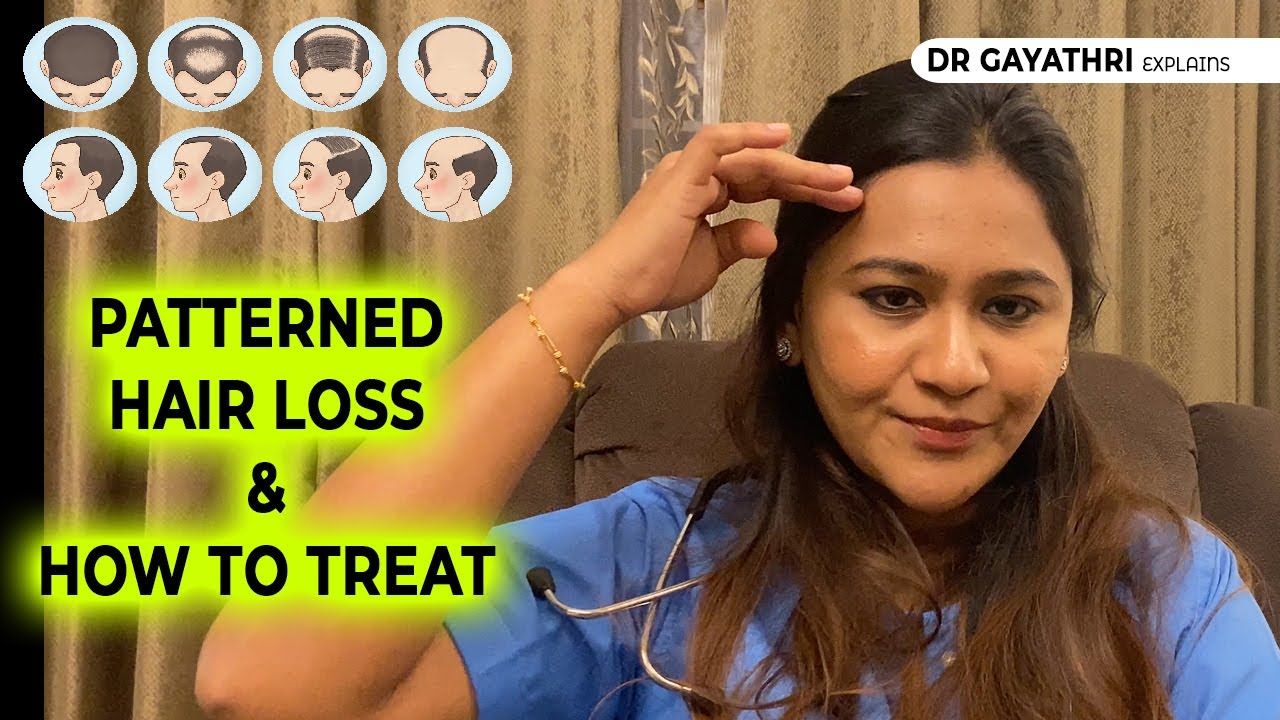 Patterned Hair Loss - Tamil Skin Care - Dr Gayathri Rajesh - Dermatologist in Chennai
