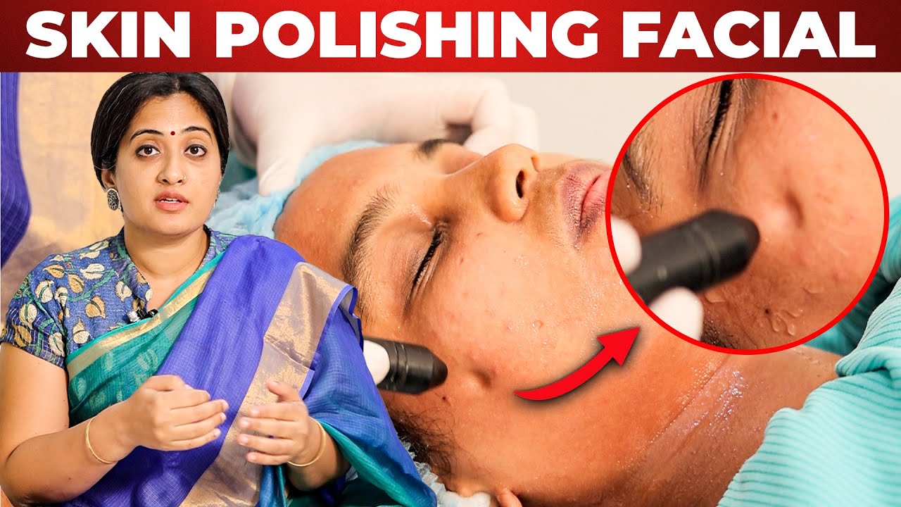 Skin Polishing Treatment Procedure for Glowing & Smooth Skin | Microdermabrasion |Dr. Shwetha Rahul