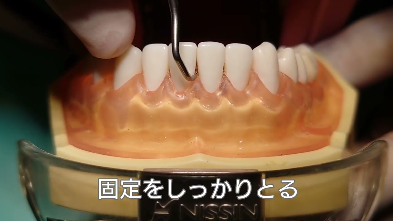 鎌形スケーラーの当て方・動かし方
