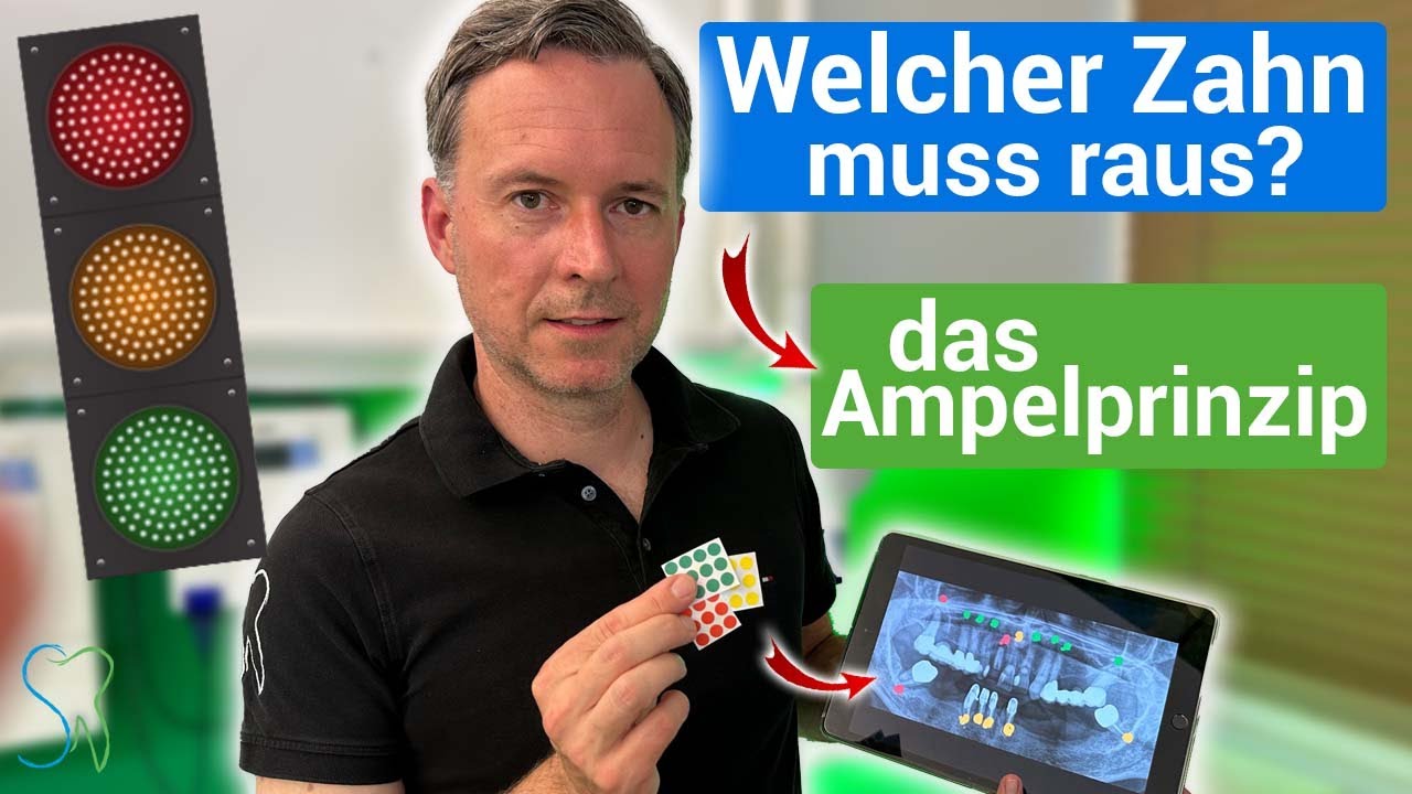 Zahnextraktion | Welche Zähne müssen raus? Das Ampelprinzip