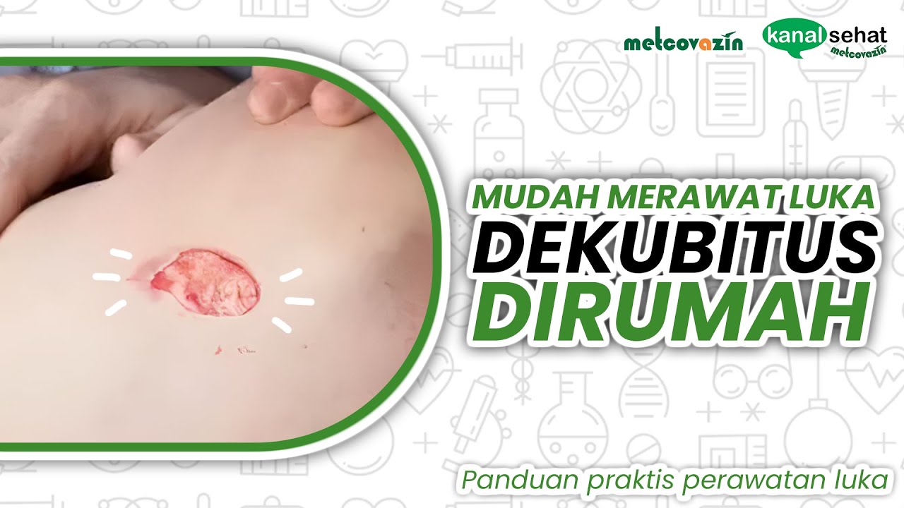 CARA MERAWAT LUKA DEKUBITUS / PERAWATAN LUKA DEKUBITUS DIRUMAH